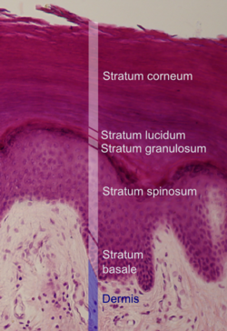250px-Epidermal_layers.png