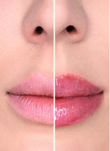 LipBooster™ (Benzyl...