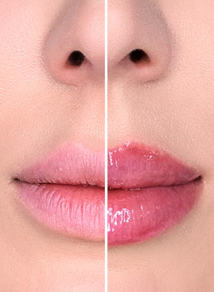 LipBooster™ (Benzyl nicotinate)