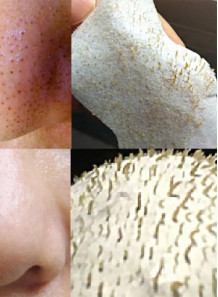 Mask ลอกสิว (Acne Pore Pack)