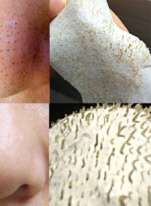 มาส์กลอกสิว Pore Pack (เบส, ไม่มีสี ไม่มีกลิ่น)