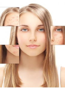 Kojic Acid Dipalmitate (Kojic DPT™)
