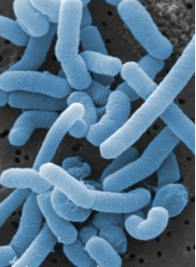  Lactobacillus paracasei (400 billion/g) (Freeze-dried)