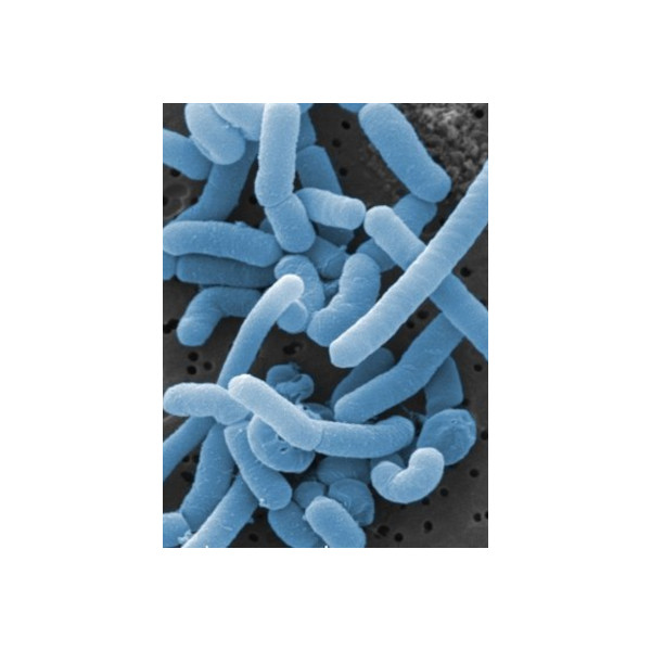 Lactobacillus Paracasei
