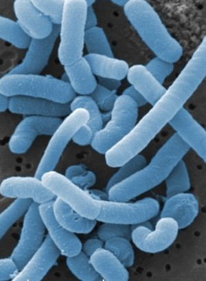 Lactobacillus paracasei (400 billion/g) (Freeze-dried)