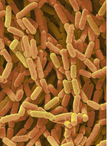 Lactobacillus rhamnosus...