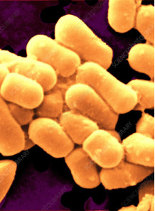 Lactobacillus fermentum (200 billion/g) (Freeze-dried)