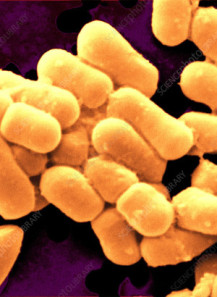 Lactobacillus fermentum...