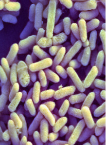 Bifidobacterium infantis (100 billion/g) (Freeze-dried)