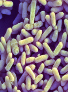 Bifidobacterium infantis...