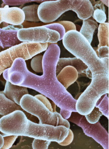 Bifidobacterium animalis (500 billion/g) (Freeze-dried)