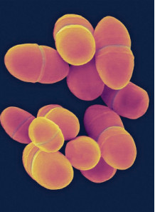 Lactococcus lactis (300 billion/g) (Freeze-dried)