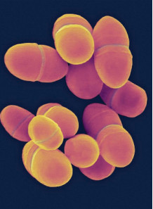  Lactococcus lactis (300 billion/g) (Freeze-dried)