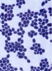 Saccharomyces boulardii (20 billion/g) (Freeze-dried)