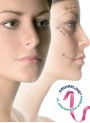 Argireline®