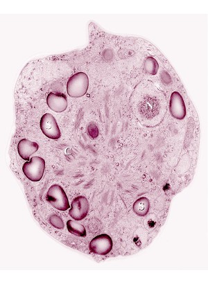 Snow Algae