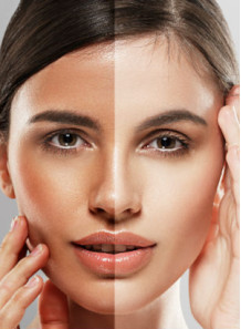 GentiWhite™ (Methyl Gentisate)