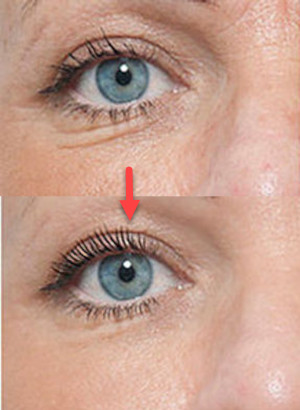 FoundationFix™ (Wrinkle Remover)