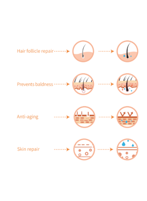 Micro SRHC III (recombinant humanized collagen type III)