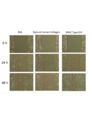 SRHC XVII (Recombinant human collagen type XVII, a1)