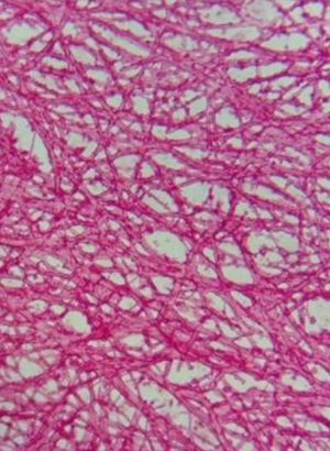 Egg Shell Membrane Collagen