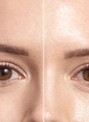 UltraBlur™ (Skin Blurring Silica)