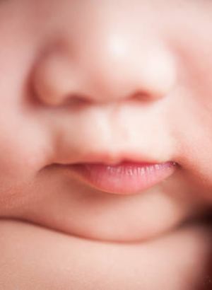 LipX®-Baby (Amino Acids For Lip Care)