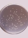 Detection of Escherichia coli