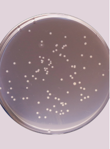 Detection of Staphylococcus aureus (Mannitol Salt Agar)