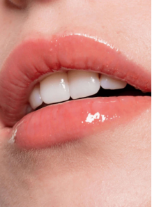 GlossSeal™ (Shine & Dry Lip...