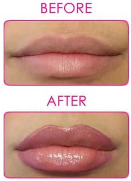 InstantPlump™ (Lip Plumper)