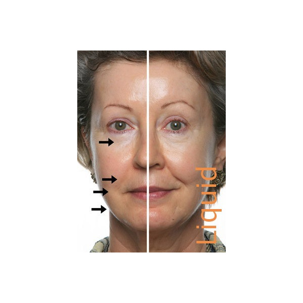 DMAE (dimethylaminoethanol) Perricone MD's Secret - reduces wrinkles ...