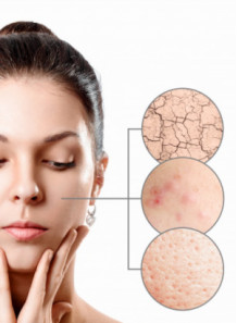 Skin Barrier Cream Base