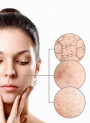 Skin Barrier Cream Base