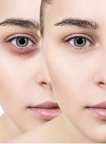 EyeSooth™ (Epigallocatechin Gallatyl Glucoside)
