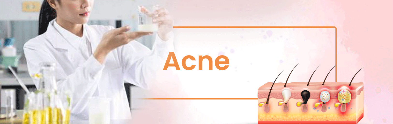Anti Acne Cosmetic Ingredients