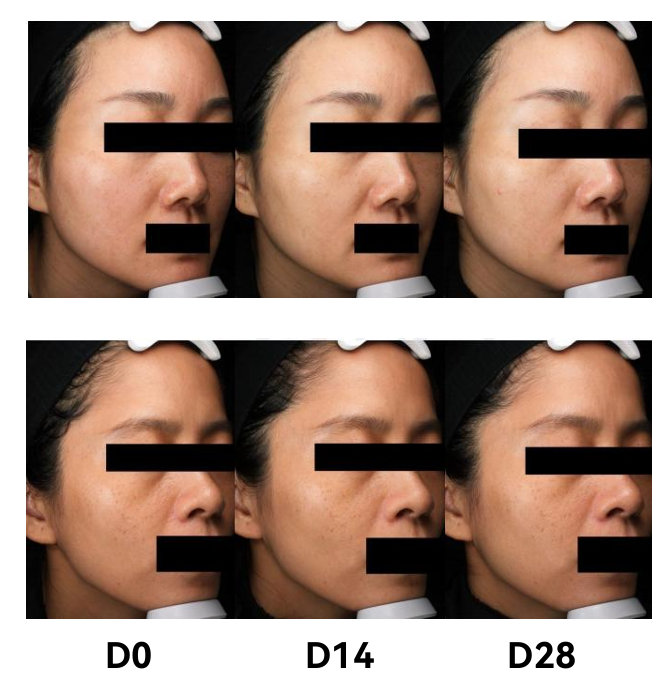Ceracare%E2%84%A2%20Liposome-3%20brightening.png