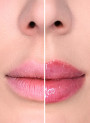 LipBooster™ (Benzyl nicotinate)