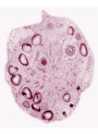 Snow Algae