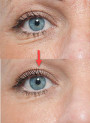 FoundationFix™ (Wrinkle Remover)