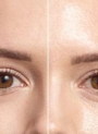 UltraBlur™ (Skin Blurring Silica)