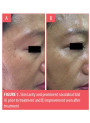 Epidermal Growth Factor (EGF, Recombinant)