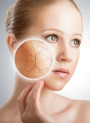SKIN-DEFENSE® V ลดระคายเคืองจากธรรมชาติ